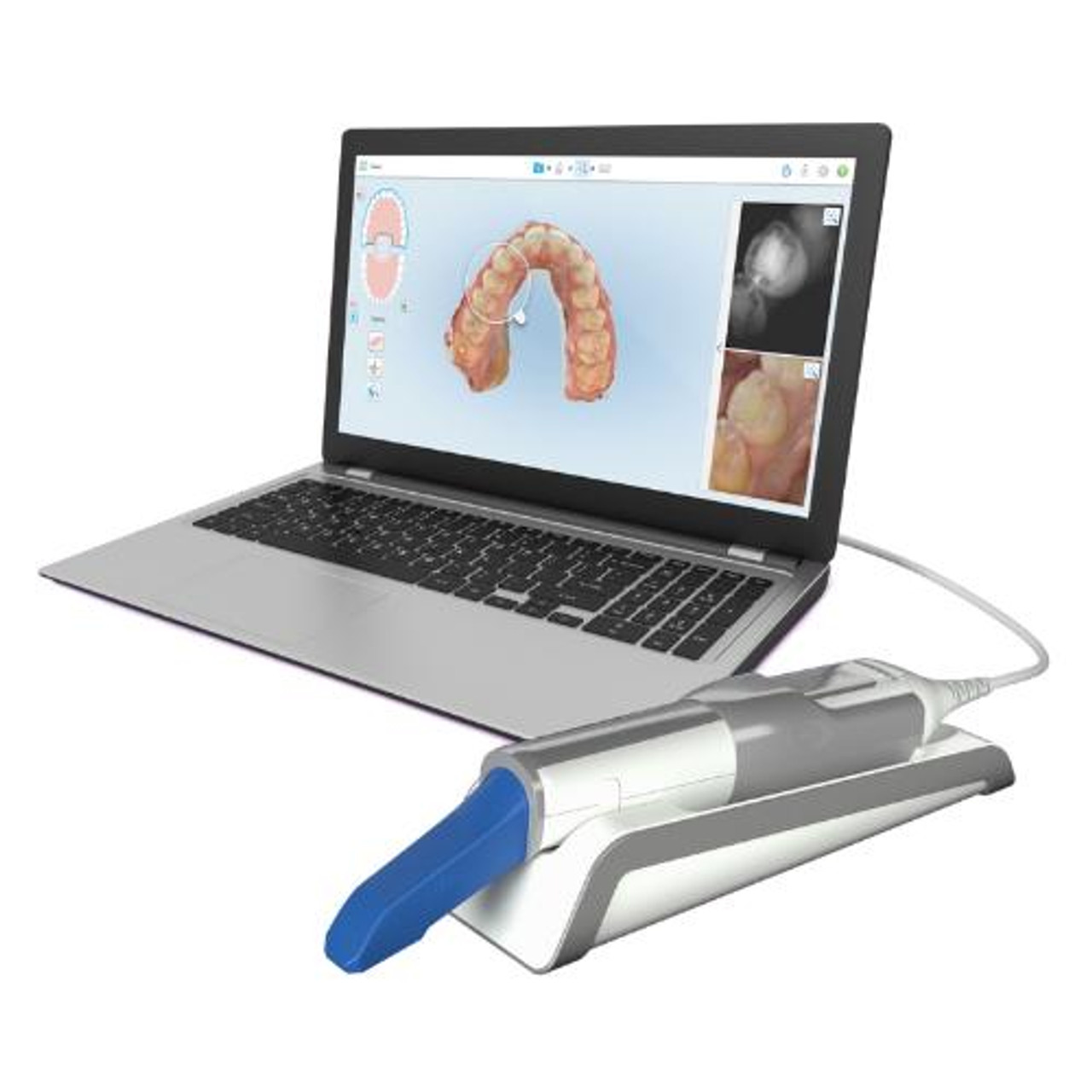 itero-itero-element-5d-certified-pre-owned-intraoral-scanner-laptop__12849